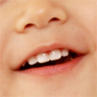 小児の歯科治療