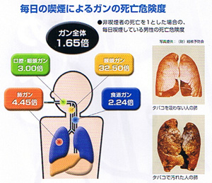 健康を損なうタバコ